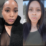 turmeric and kojic acid soap before and after photo 2